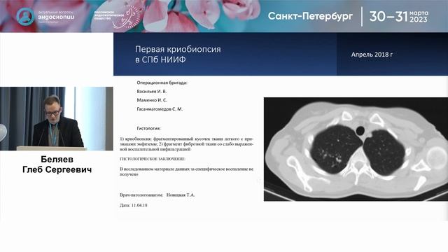 Криобиопсия в России - десять лет пути смотреть онлайн