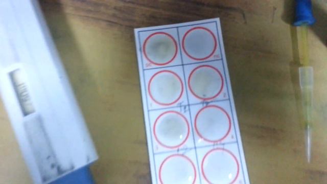 RPR test смотреть онлайн