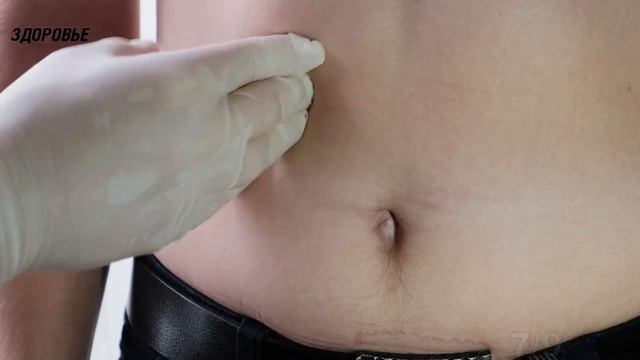 Даже в аптеке удивились! Семена укропа запускают в теле человека процессы... смотреть онлайн