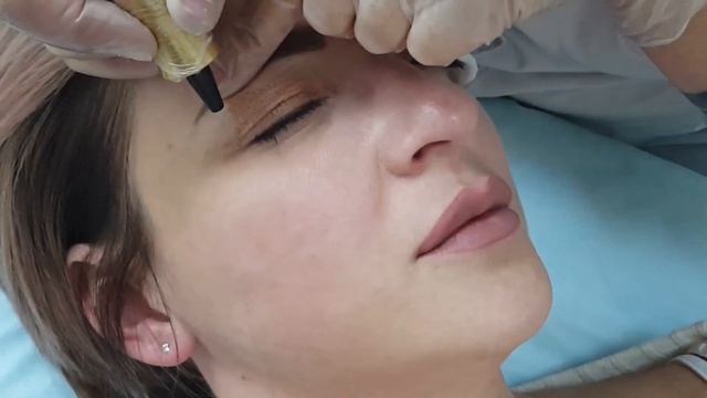 Plasma Liner отзыв Косметолога (Часть 1)