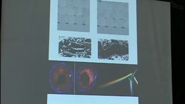 Лекция доктора Кутушова на тему: теория возниковения рака смотреть онлайн