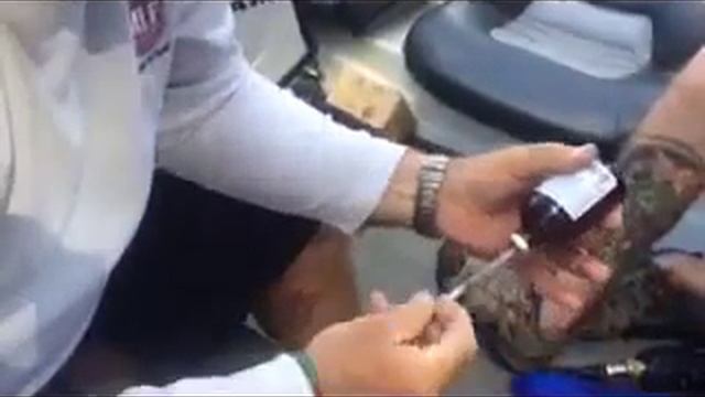 Selfie hook removal part 1 - Lidocaine injections смотреть онлайн