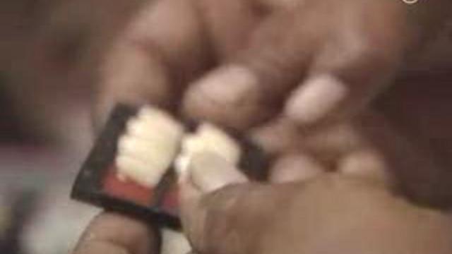 стоматология в индии смотреть онлайн