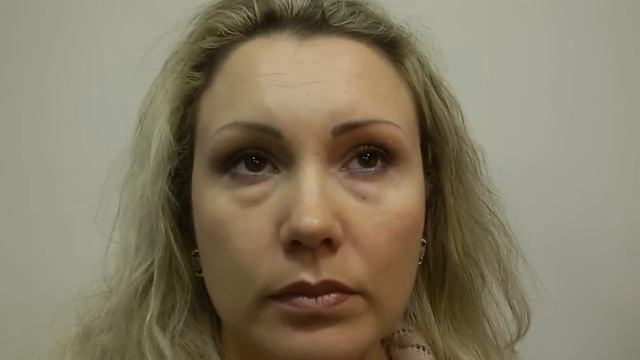 Как быстро избавиться от некрасивых мешков под глазами! Результат потрясающий! смотреть онлайн