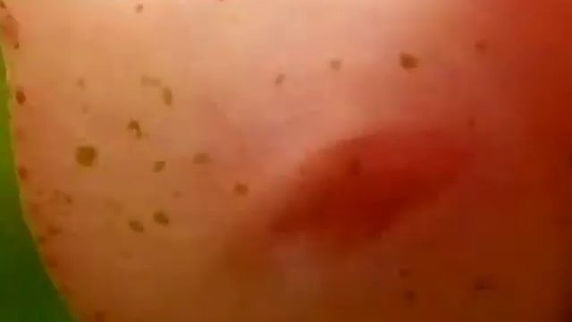 Зубы улитки/Teeth of the snail/Zähne der Schnecke смотреть онлайн