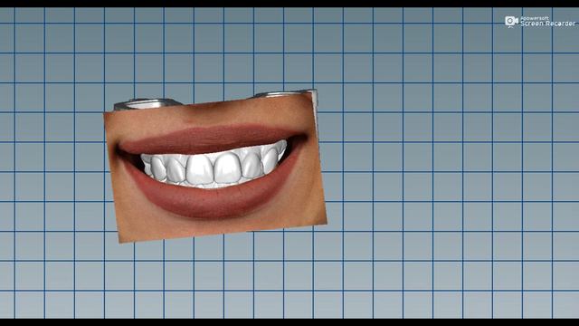 Enceramento Diagnóstico com foto смотреть онлайн