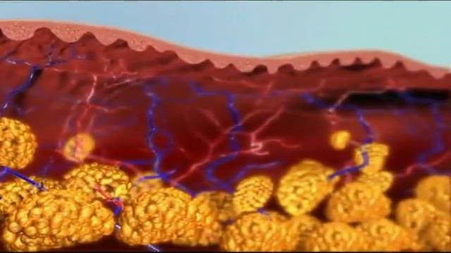 рф лифтинг Мурманск смотреть онлайн