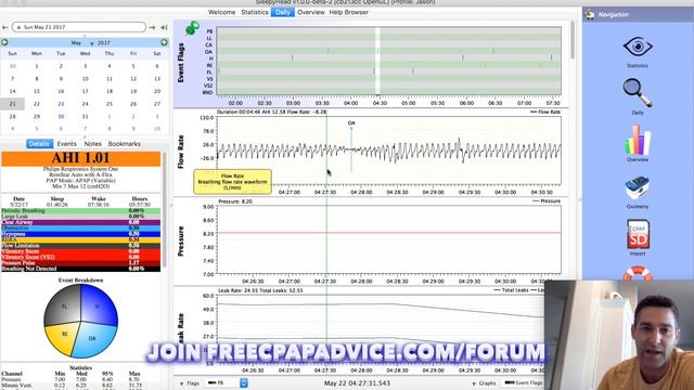All CPAP Users Need This. SleepyHead (Now OSCAR) Download And Tutorial. Monitor CPAP Therapy