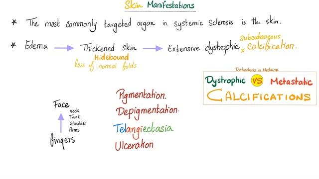 Scleroderma Pathogenesis and Clinical Manifestations (Detailed Explanation) смотреть онлайн
