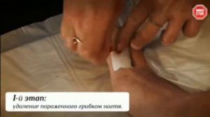 МИКОСТОП крем-паста и лосьон
