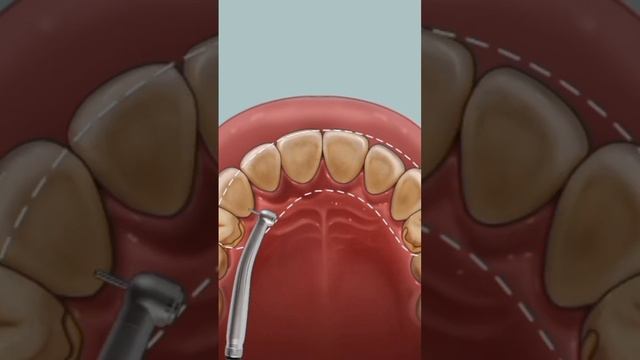 asmr. A GIRL CAME FOR HELP TO CURE THE TEETH смотреть онлайн