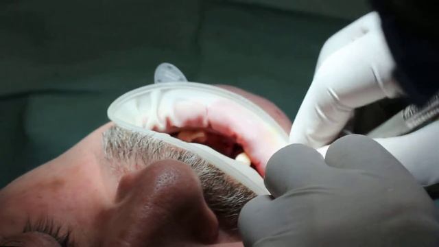 Стоматологическая клиника «Кастелини» в Махачкале смотреть онлайн