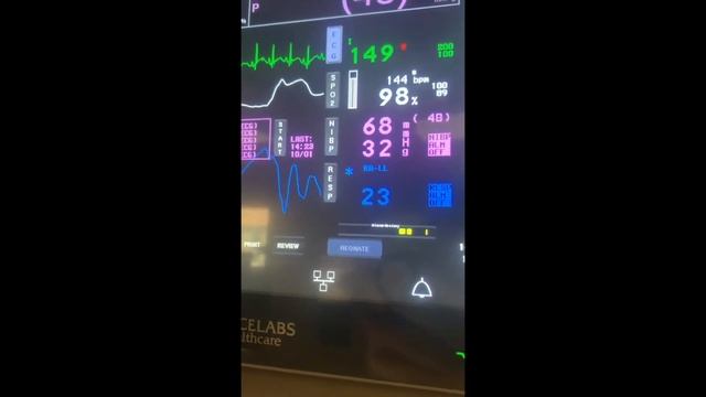 How to quickly learn to read a cardiac monitor смотреть онлайн