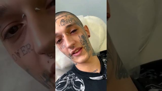 Закрасил глаз в 17 лет смотреть онлайн