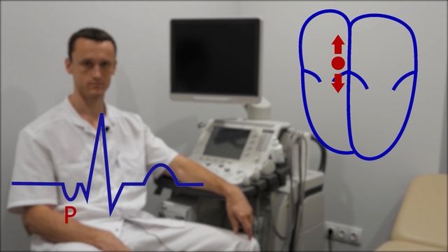 Экстрасистолия (экстрасистолы).