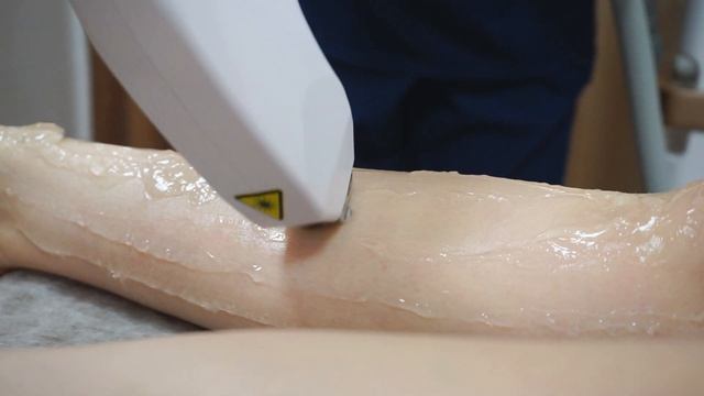 Лазерная эпиляция в «Физио-МЕД», Абакан смотреть онлайн