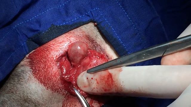 lymph node metastatic adenocarcinoma causes salivation смотреть онлайн