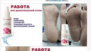 Препаратный педикюр с профилактической  косметикой INKI. Спикер Татьяна Рупасова.