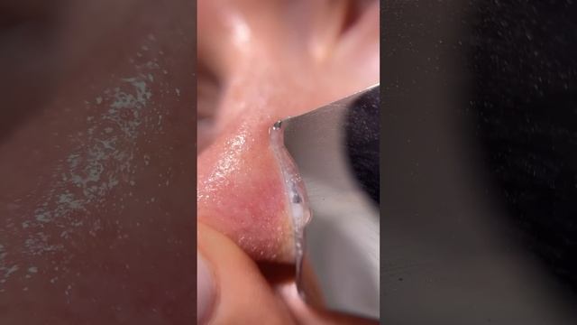 Ультразвуковая чистка дома с УЗ-пилингом Readyskin Nova смотреть онлайн