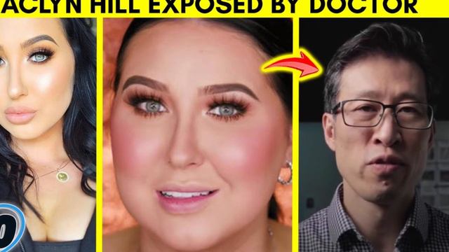 Woman Addicted To Face Filler Says It Gets Her More Romantic Attention смотреть онлайн