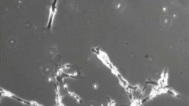 Neurons under microscope смотреть онлайн