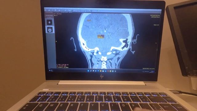 Capture saved to new series in Radiant DICOM viewer смотреть онлайн