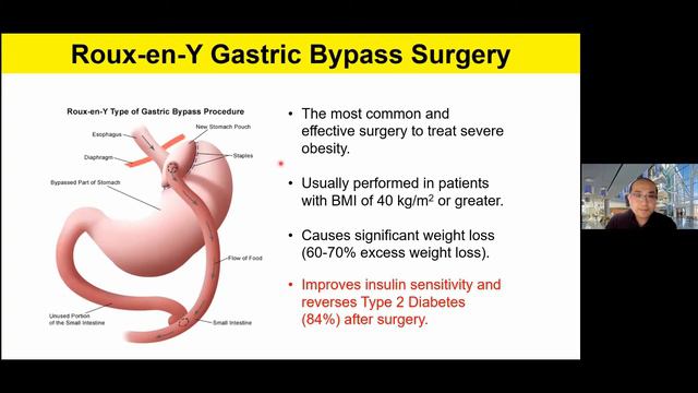 "Targeting Mitochondrial Dynamics to Reverse Skeletal Muscle Insulin Resistance in Obesity” смотреть онлайн