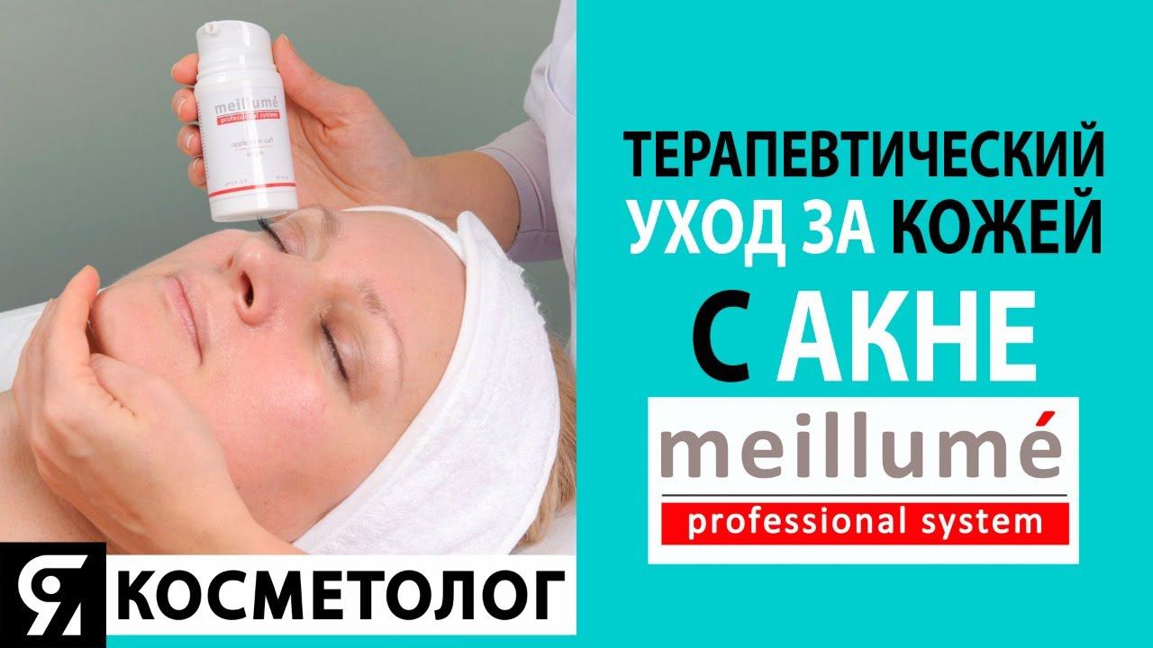 Терапевтический уход за кожей с акне смотреть онлайн