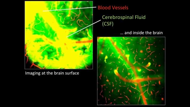 Джефф Айлифф: Во время сна мозг проводит очистку от вредных веществ. смотреть онлайн