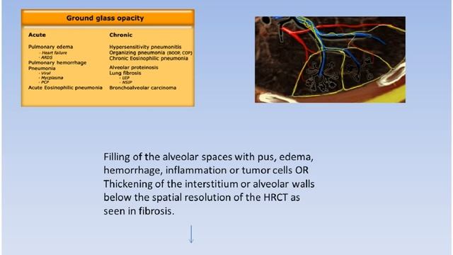 CT CHEST BASICS смотреть онлайн