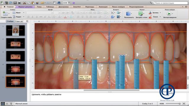 Creation of digital smile DSD (Создание цифровой улыбки) смотреть онлайн