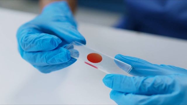 ПРОВЕРЬ СВОИ СИМПТОМЫ | 12 признаков того что у вас больные почки смотреть онлайн