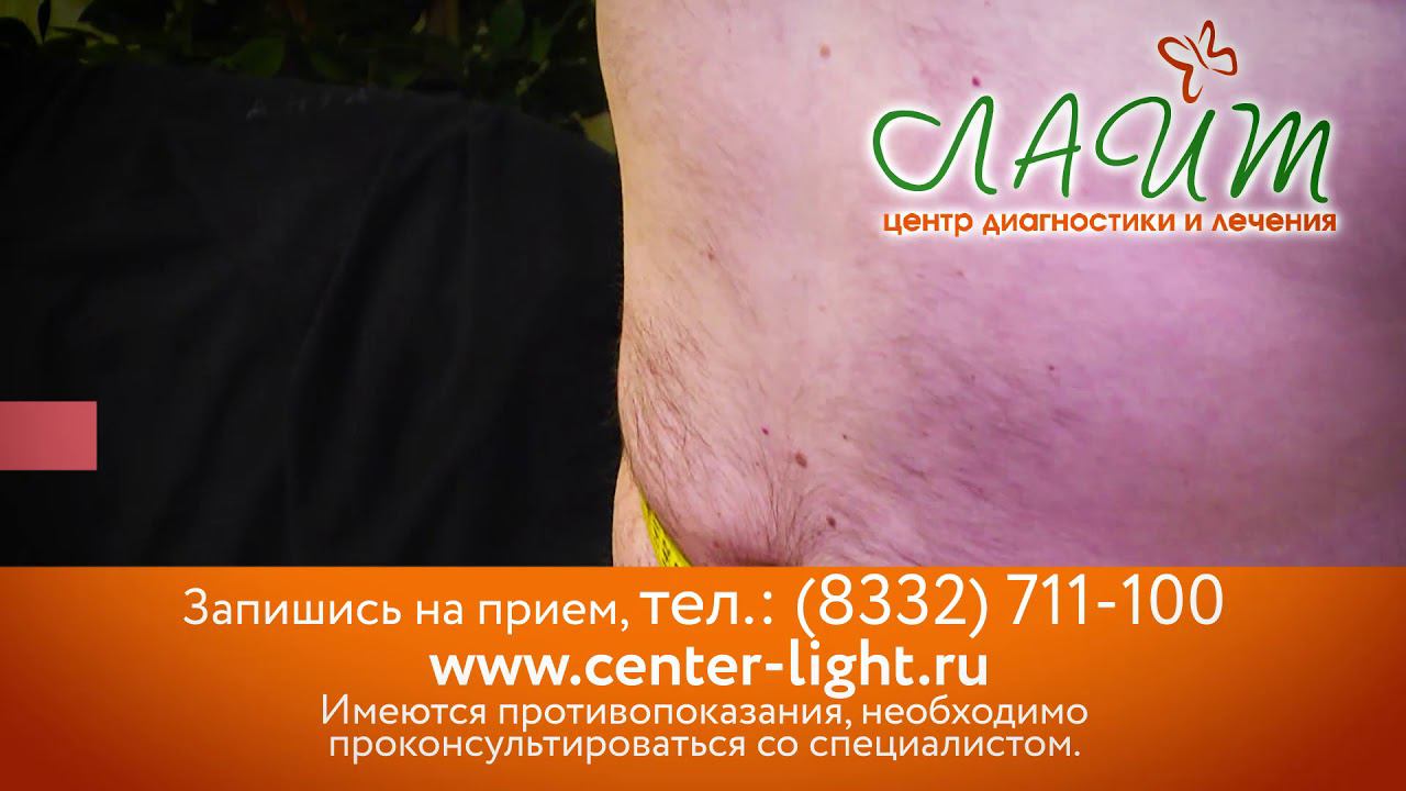 Программа коррекции веса в центральной поликлинике «Лайт»! смотреть онлайн