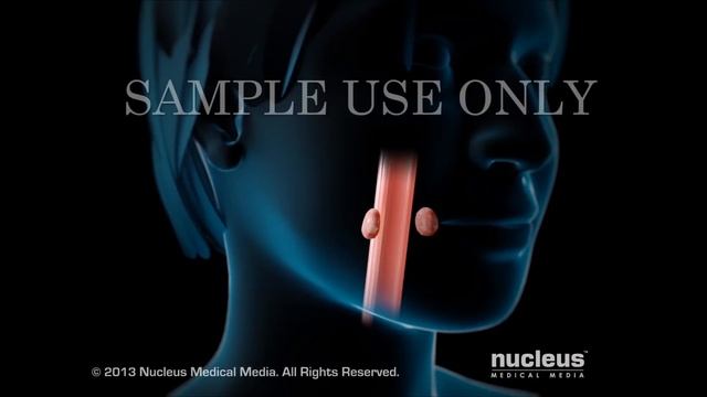 Apnea obstructiva del sueño смотреть онлайн