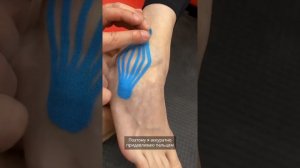 Кинезиотейпирование голеностопа