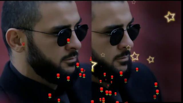 что случилось с глазом Ислам итляшев срочно слушаем и смотрим