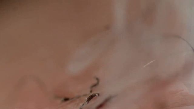 Лазерная эпиляция в питере - незаменимая процедура.