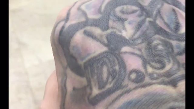 Когда сломан палец