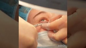 Удаление новообразования века