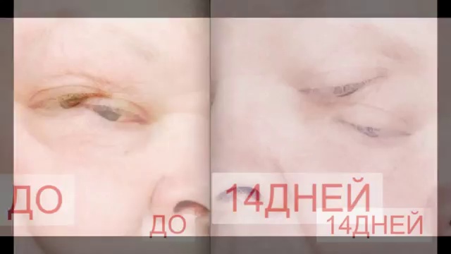 Красота и молодость лица смотреть онлайн