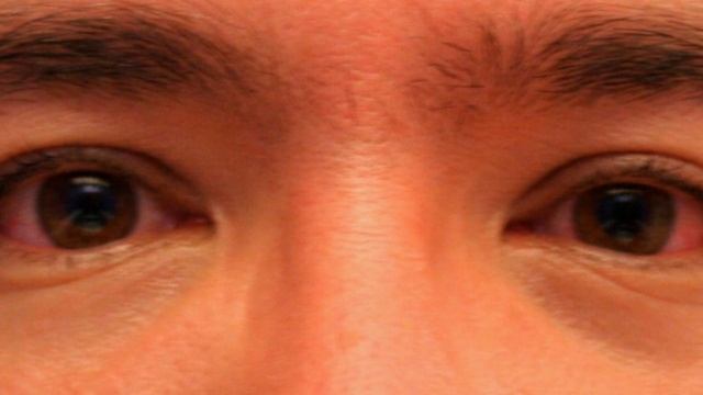 Ботулизм / BOTULISM смотреть онлайн