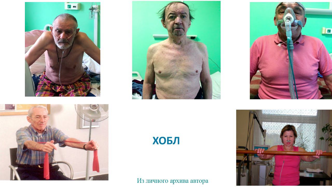 Мещерякова на Пульмоконгрессе 2021 смотреть онлайн