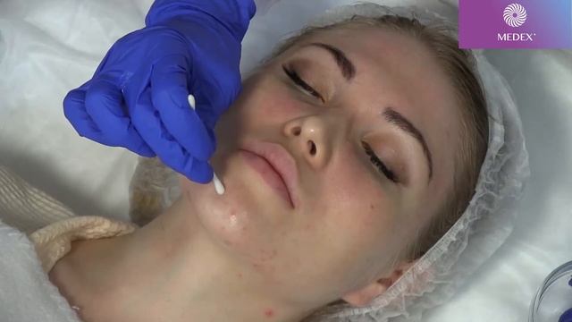 Мастер-класс Сюзанны Поррас по применению PH Formula. Часть 2