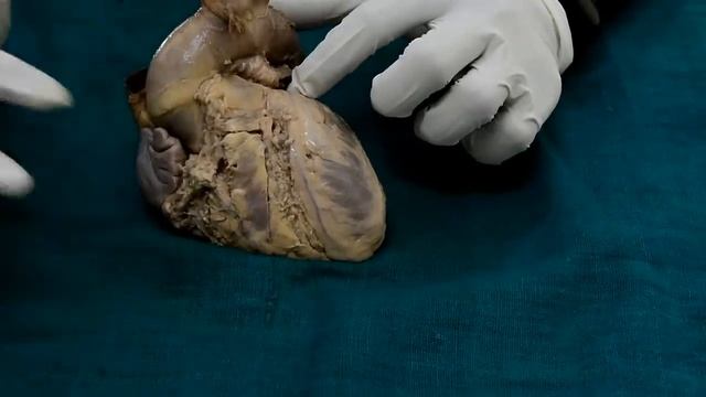 Heart - external feature смотреть онлайн