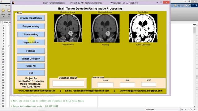 Matlab Code for Brain Tumor Detection Using Image Processing смотреть онлайн