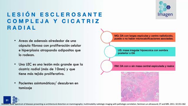 4 - Lesiones simuladoras de BI-RADS 5 | Dra. González смотреть онлайн