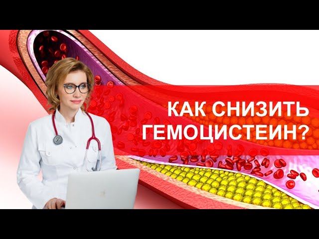 Снижаем гомоцистеин. Кардиолог Анна Кореневич смотреть онлайн
