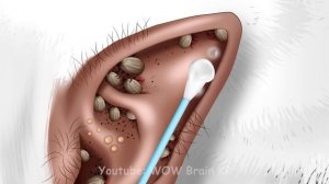 ASMR Animation Help Skibidi Toilet Help change his mechanical eyes | WOW Brain Satisfying Video