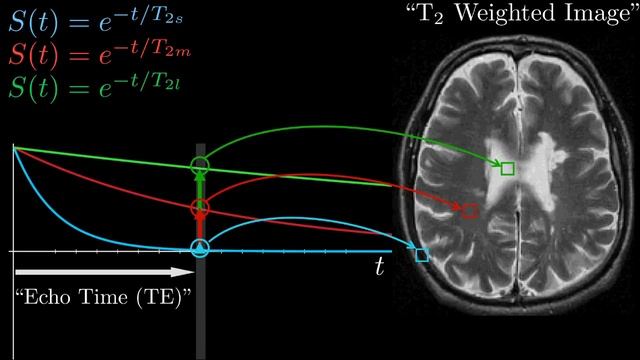 How MRI Works - Part 1 - NMR Basics смотреть онлайн