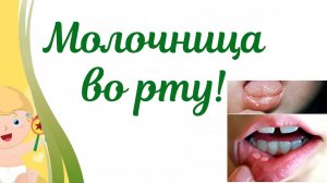 Молочница ротовой полости у ребенка! Что делать?